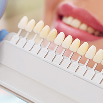 Dental Crowns