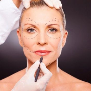 Facelift